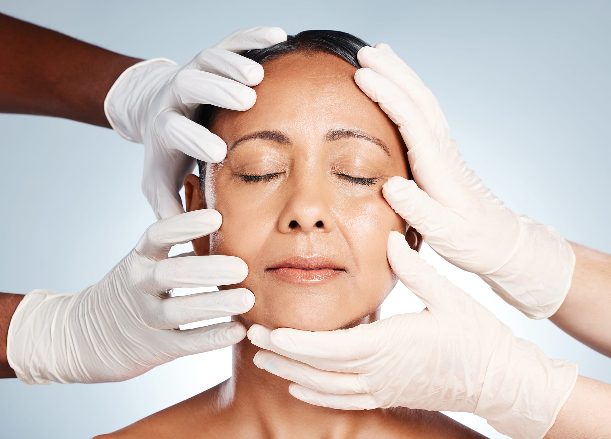 Paciente tras tratamiento de flacidez facial sin cirugía con endolifting láser en Sevilla