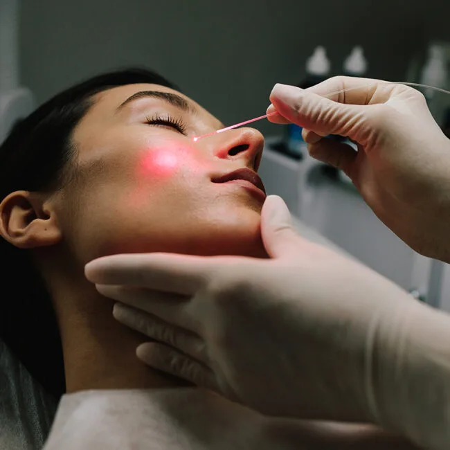 Formación en endoláser K-Laser Blue para médicos, con enfoque práctico y seguro. Aprendizaje sobre pacientes reales y grupos reducidos.