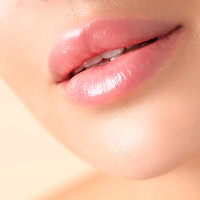 Aumento de labios natural con ácido hialurónico