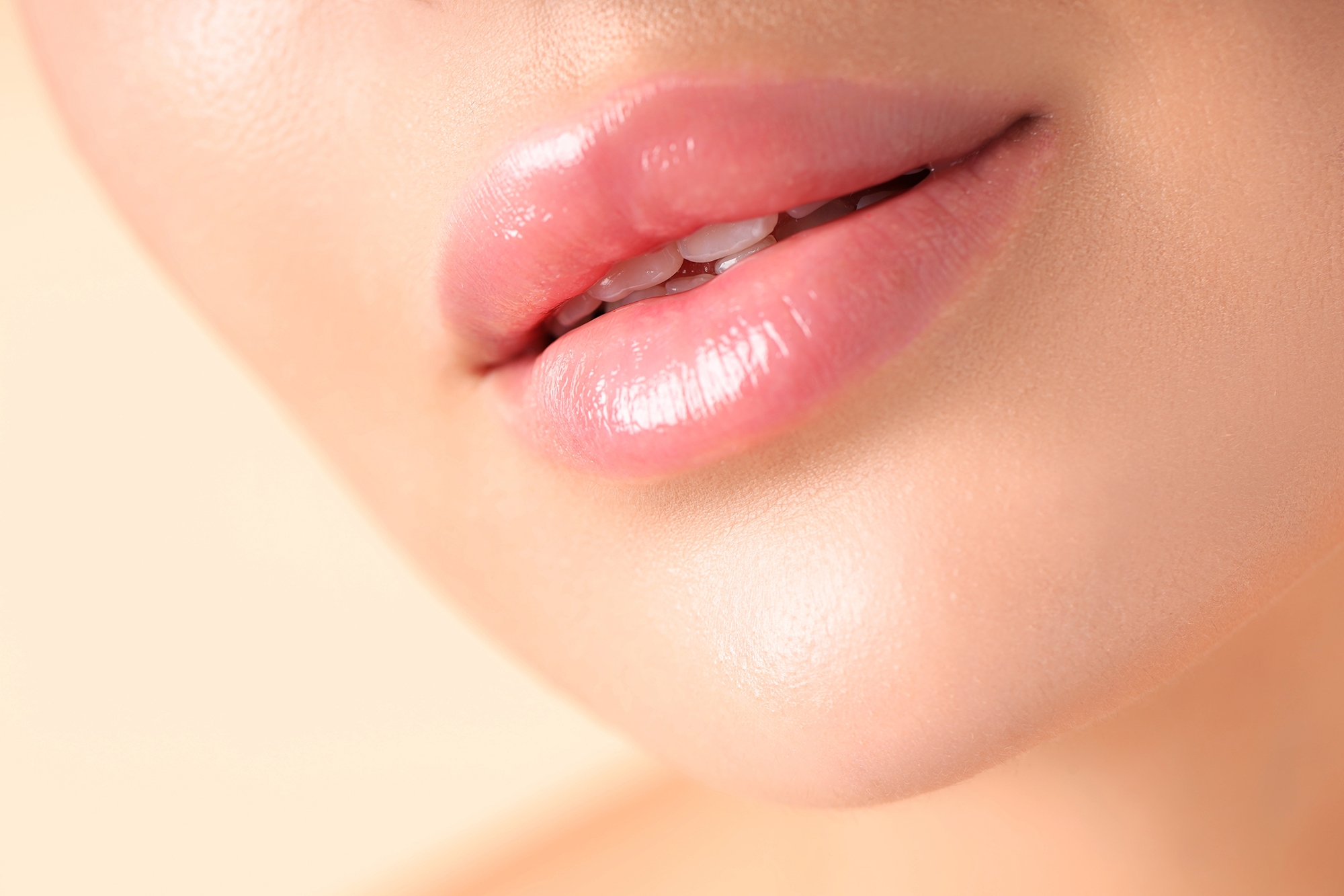 Aumento de labios natural con ácido hialurónico