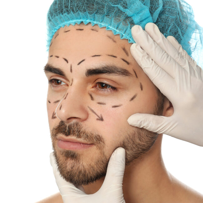 Hombre tras armonización facial masculina en Sevilla