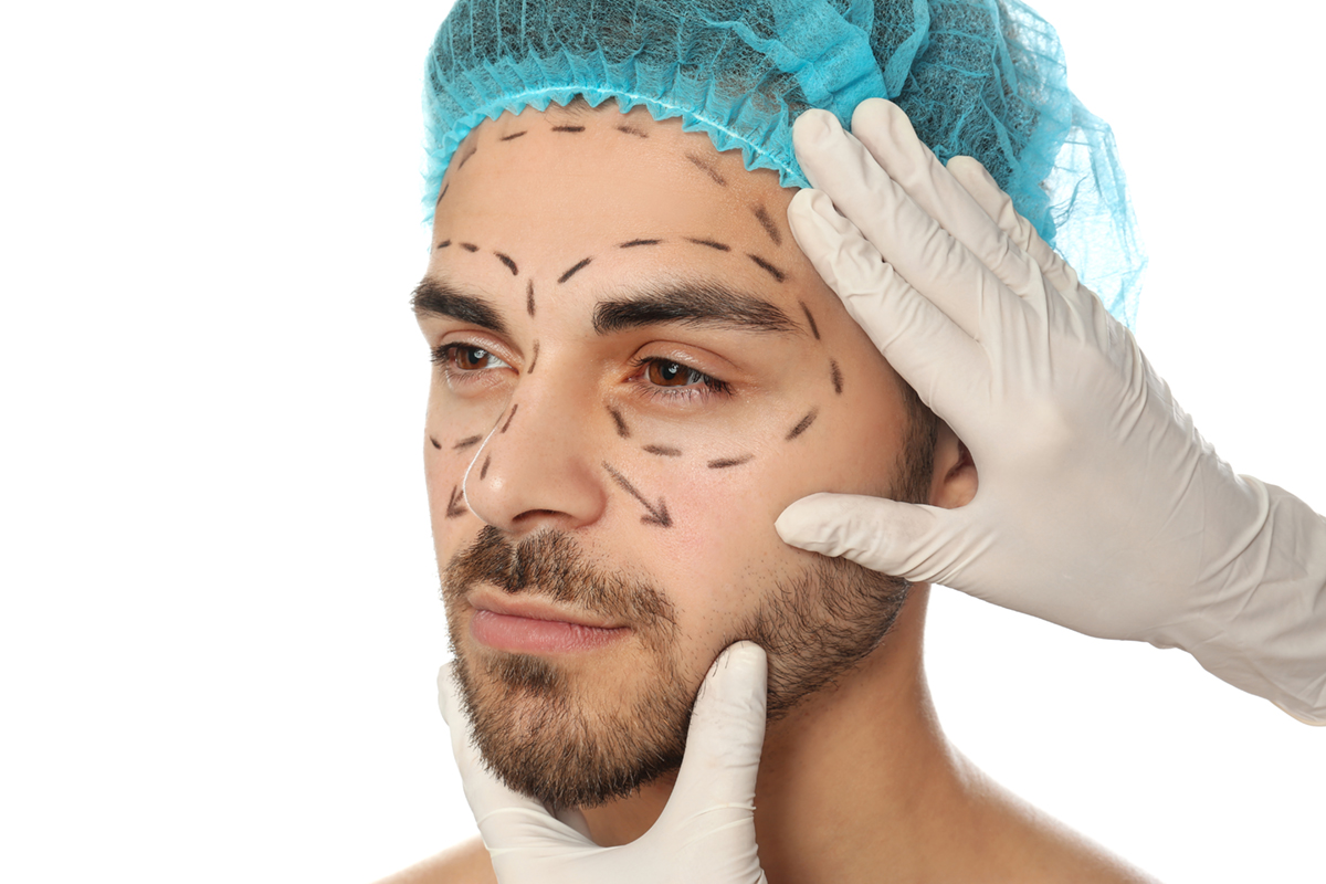 Hombre tras armonización facial masculina en Sevilla